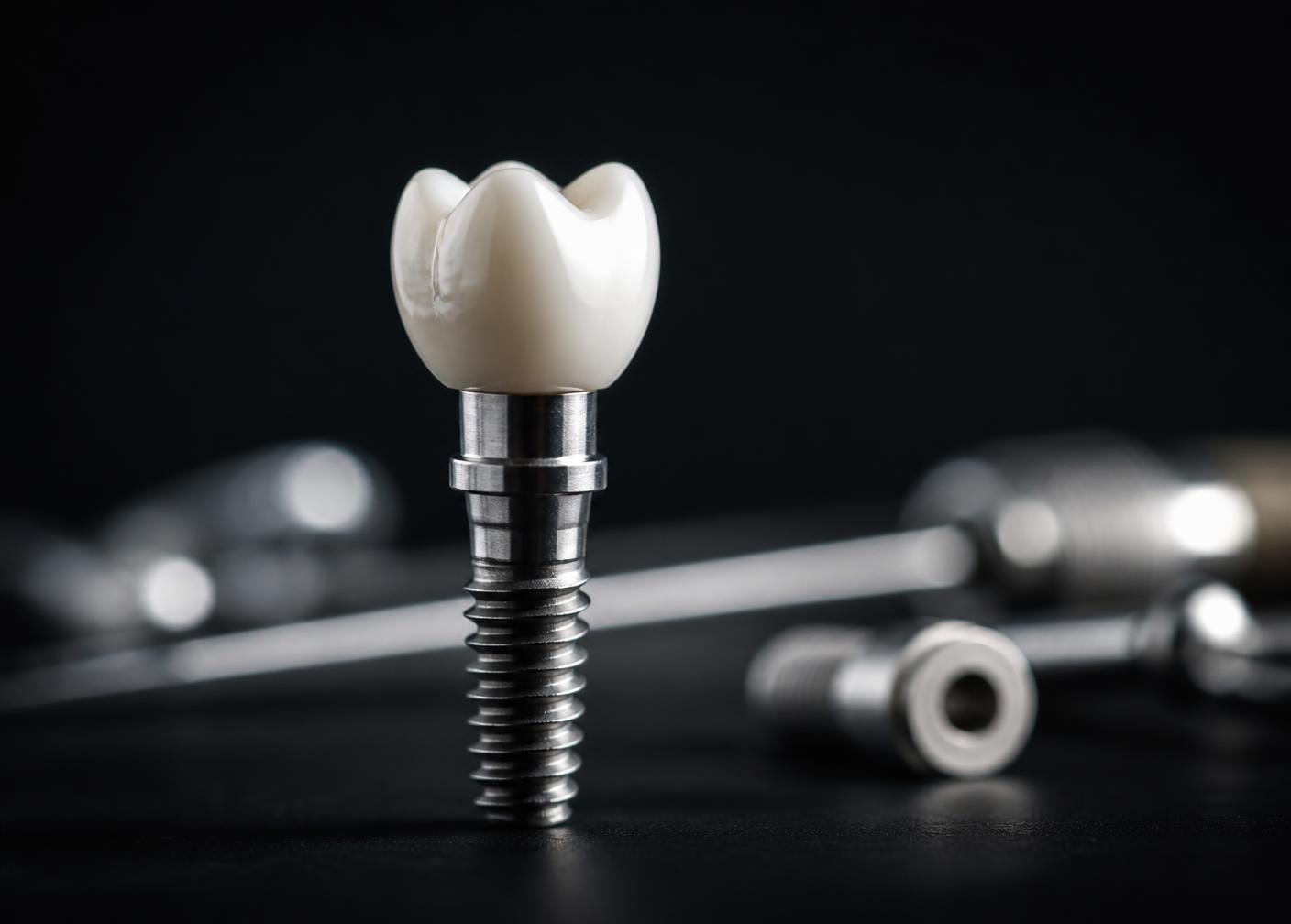 Implante dentário de titânio com coroa estética